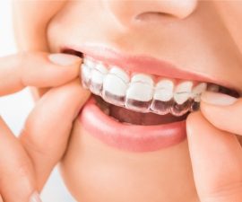Chăm-sóc-răng-miệngNhững-Phương-Án-Niềng-Răng-3D-Hiện-Nay (1)